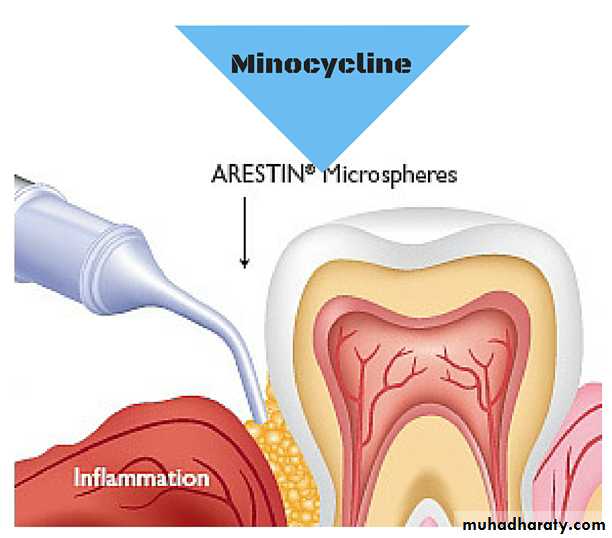 medicaments for periodontal diseases