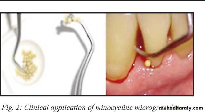 medicaments for periodontal diseases