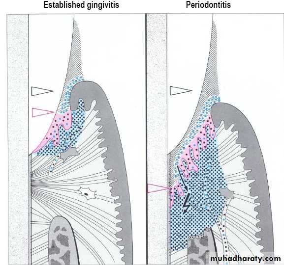medicaments for periodontal diseases