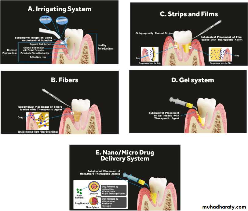 medicaments for periodontal diseases