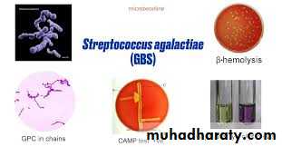 Streptococcus Part II