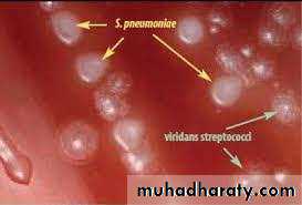Streptococcus Part II