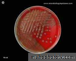 Streptococcus Part II