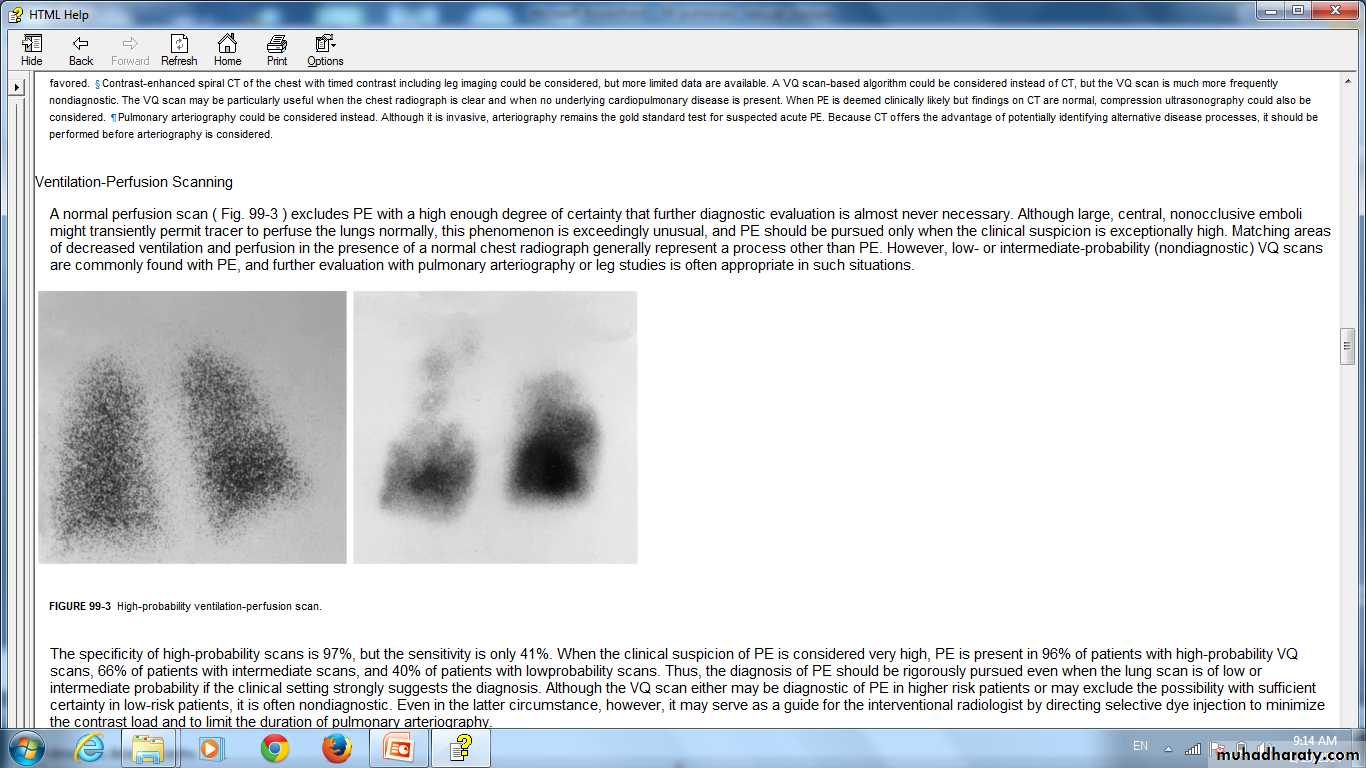 Pulmonary vascular disease