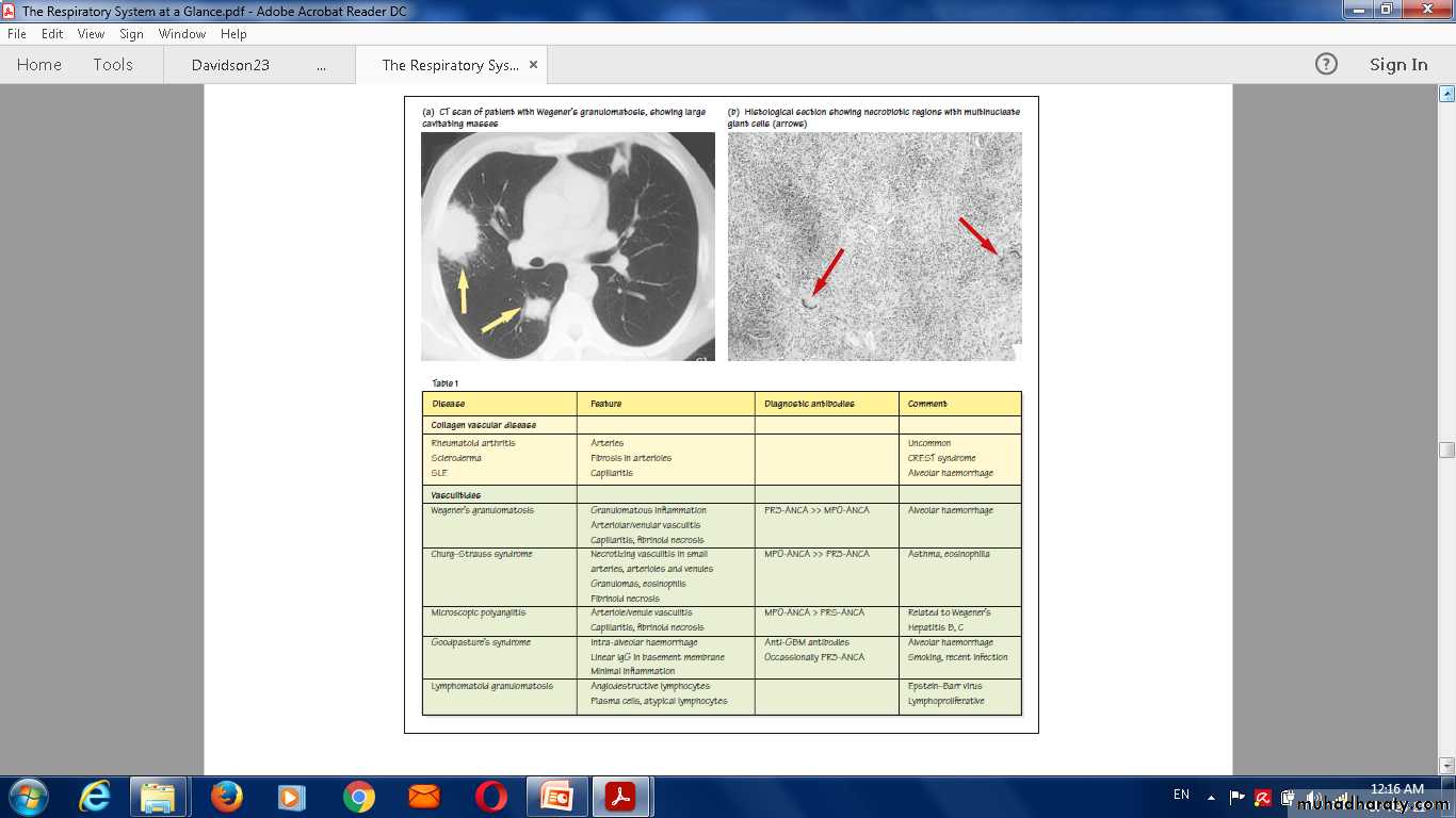 Pulmonary vascular disease