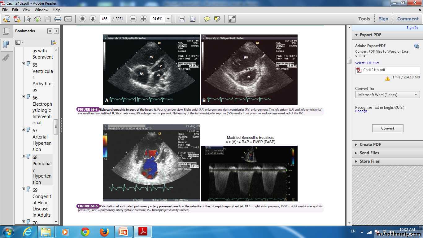 Pulmonary vascular disease
