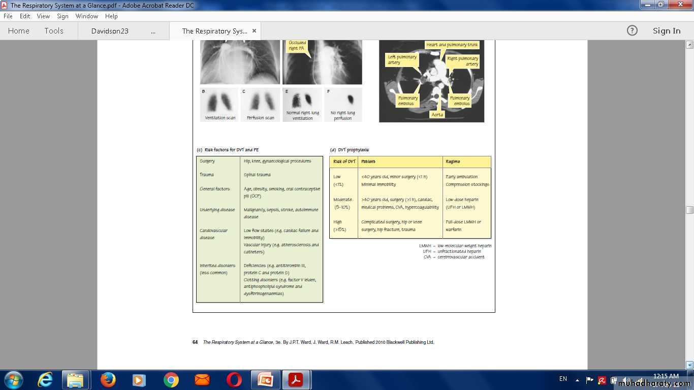 Pulmonary vascular disease