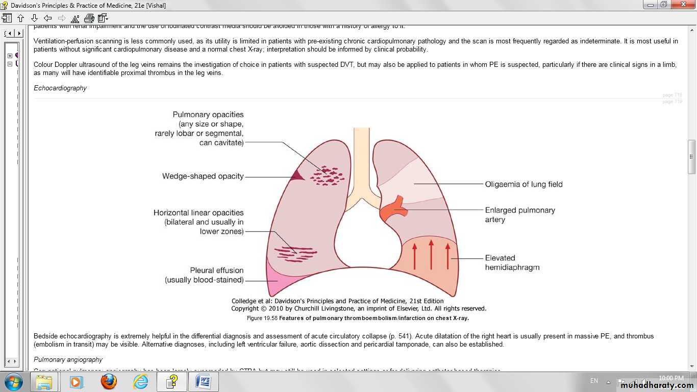 Pulmonary vascular disease