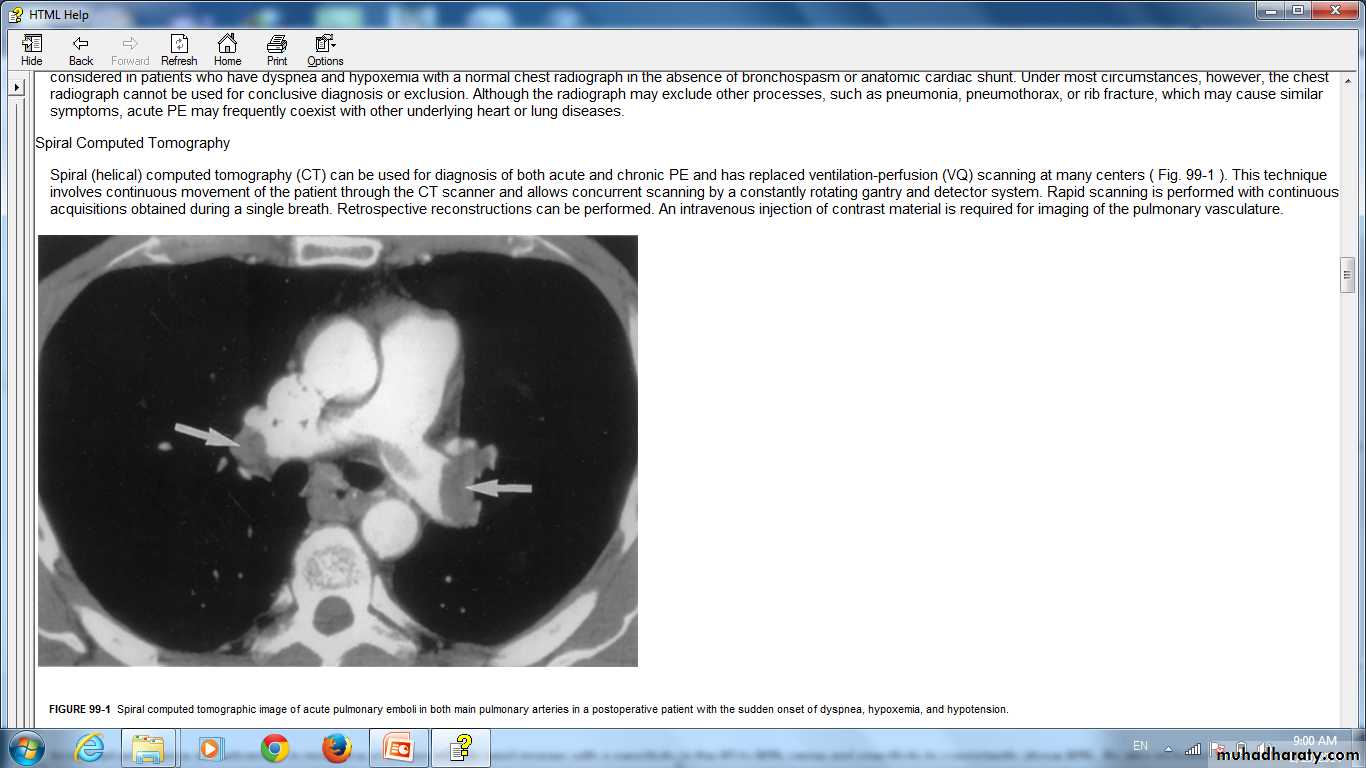 Pulmonary vascular disease