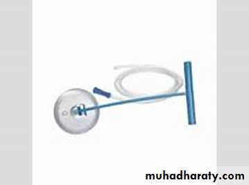 Instrumental Delivery