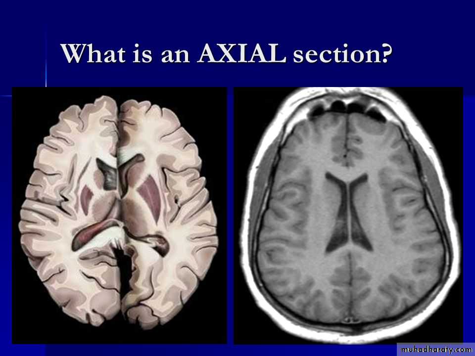 Introduction to Neuroanatomy