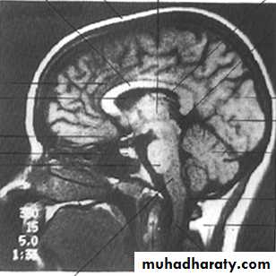 Introduction to Neuroanatomy
