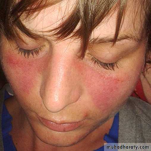 Red and white lesions