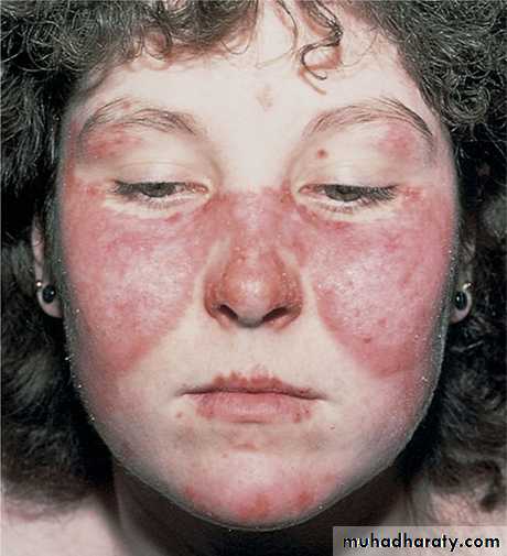 Red and white lesions