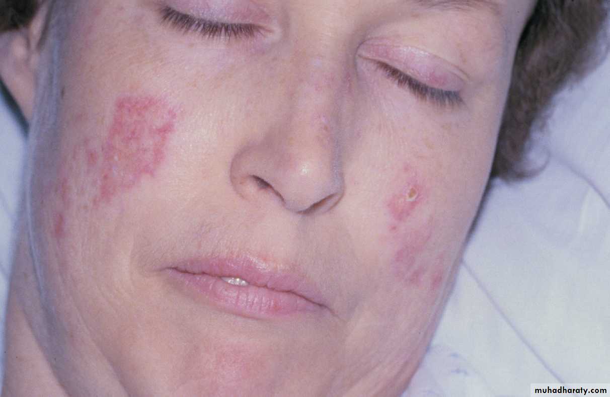 Red and white lesions