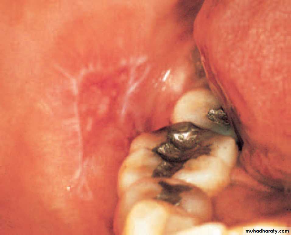 Red and white lesions