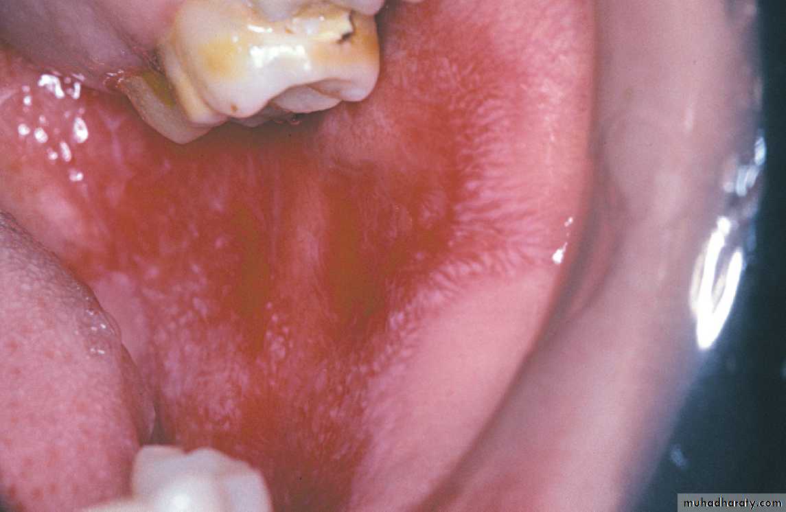 Red and white lesions