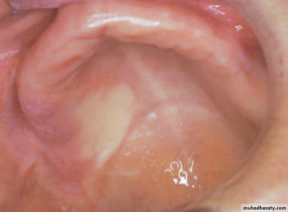Red and white lesions