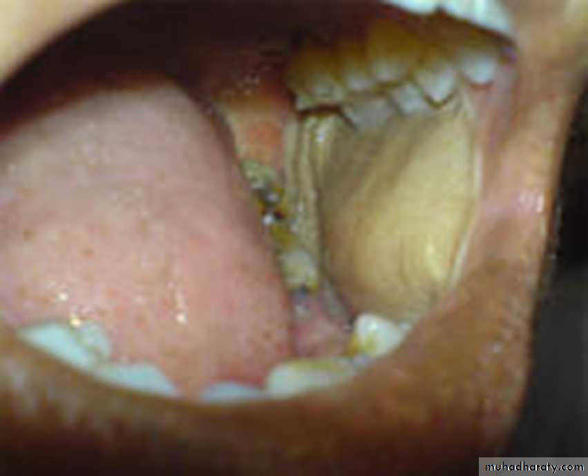 Red and white lesions