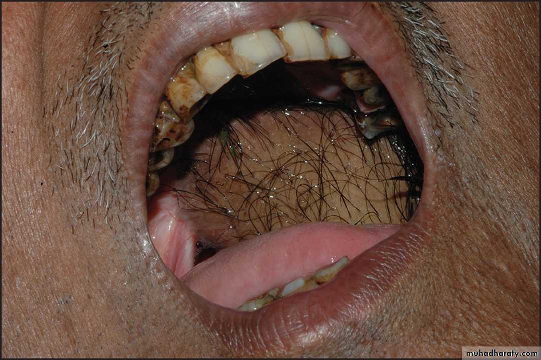 Red and white lesions