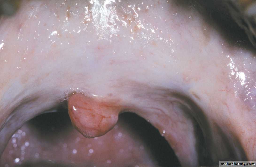 Red and white lesions