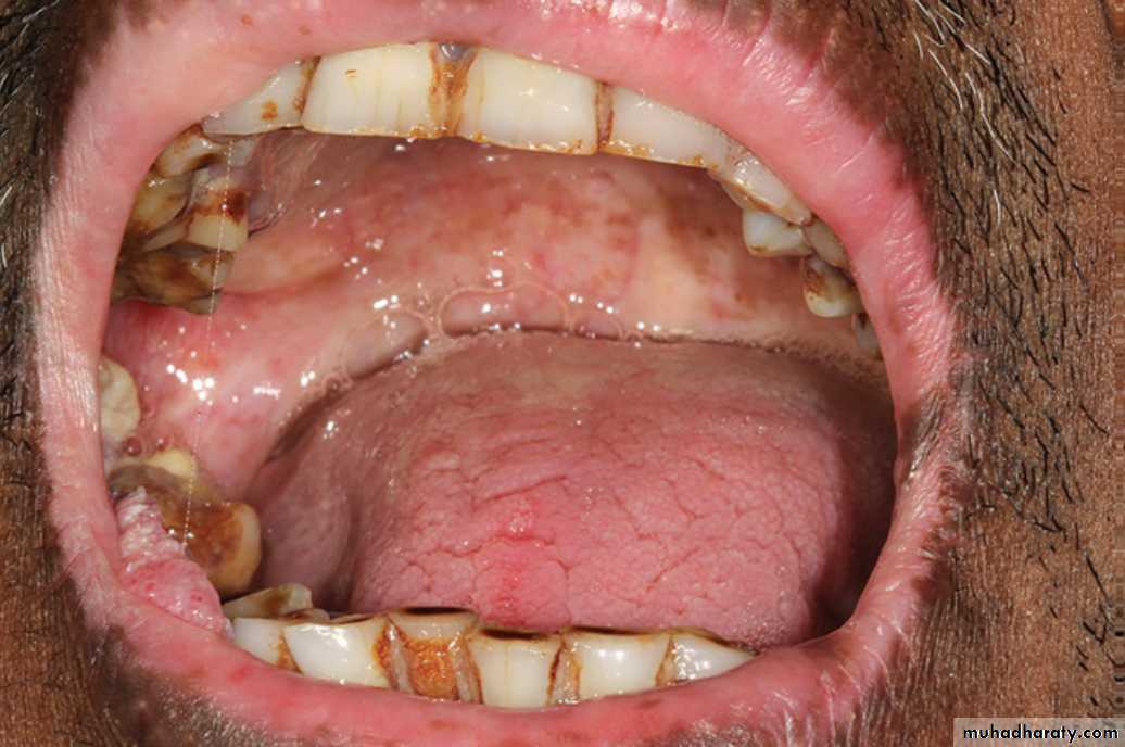 Red and white lesions
