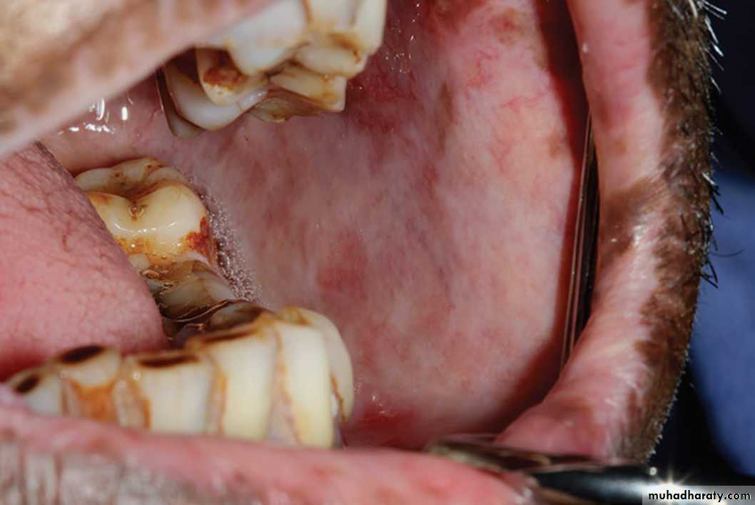 Red and white lesions