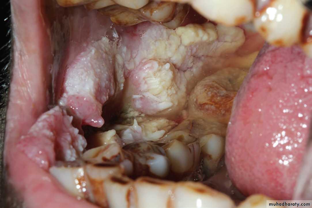 Red and white lesions