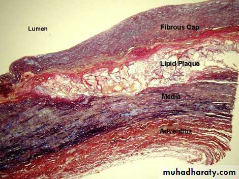 Cardiovascular system