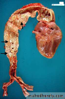 Cardiovascular system