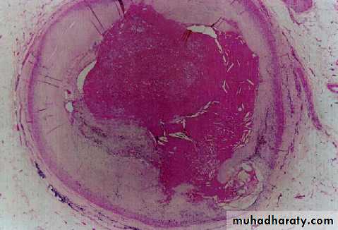 Cardiovascular system