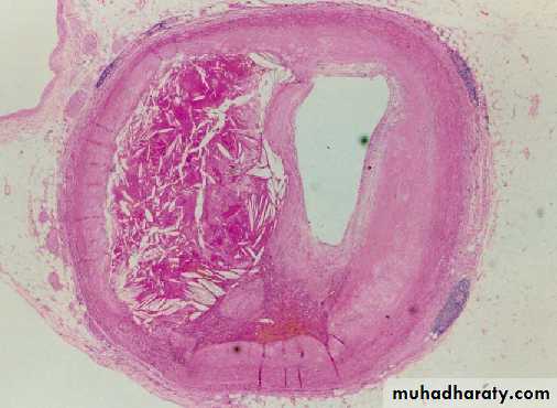 Cardiovascular system
