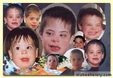 children with special needs