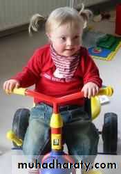 children with special needs