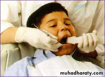 children with special needs