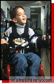 children with special needs