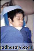 children with special needs
