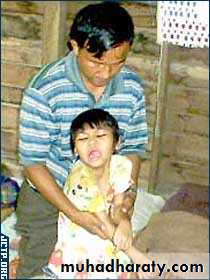 children with special needs