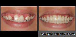 fixed prosthodontics