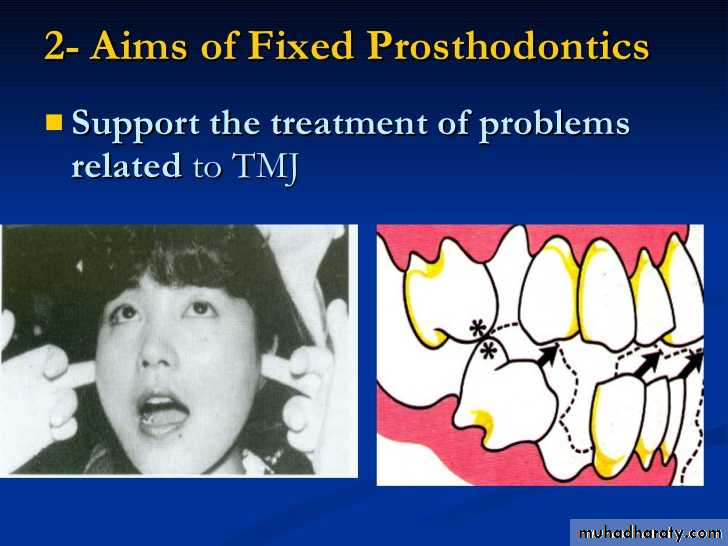fixed prosthodontics