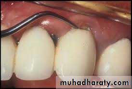 fixed prosthodontics