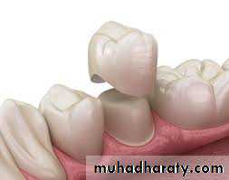 fixed prosthodontics