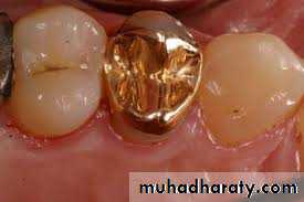 fixed prosthodontics