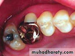 fixed prosthodontics