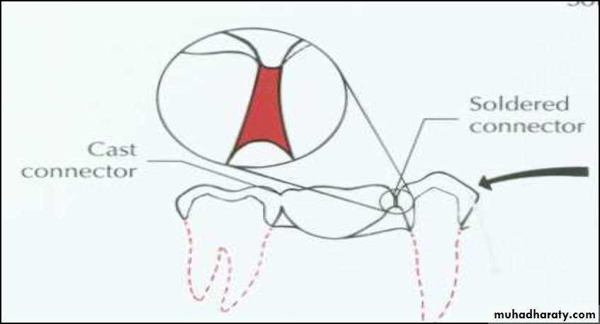 fixed prosthodontics