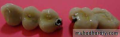 fixed prosthodontics