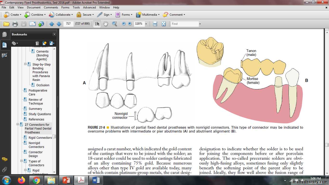 fixed prosthodontics