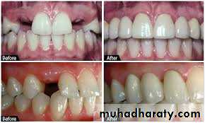 fixed prosthodontics