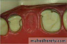fixed prosthodontics