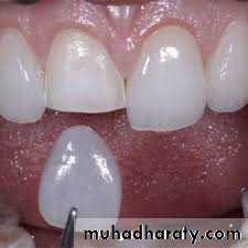 fixed prosthodontics